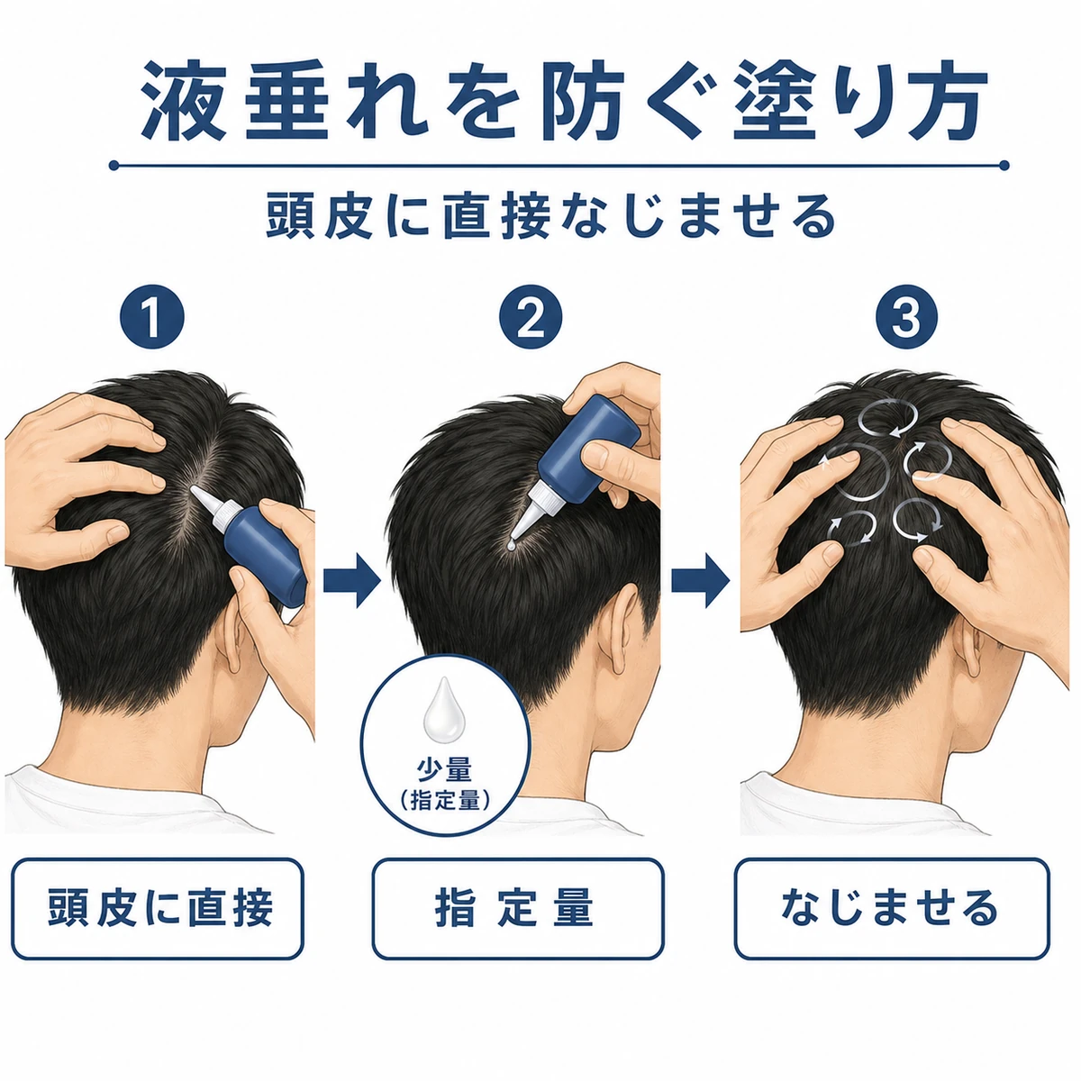 髪をかき分け頭皮に直接塗り指の腹でなじませる正しい育毛剤の塗り方の手順を表した医療イラスト