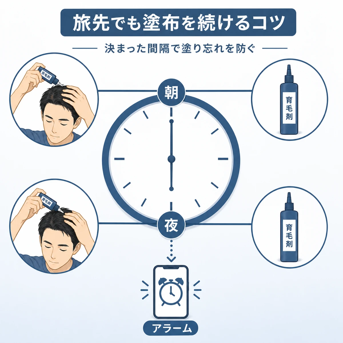 旅行中も朝晩の間隔を保って育毛剤の塗布を続ける時間管理を時計で表した医療イラスト