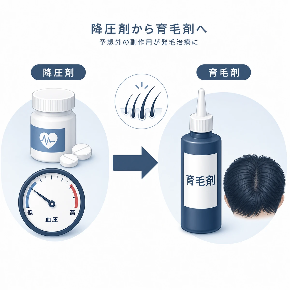 高血圧の降圧剤として生まれたミノキシジルが育毛剤へと転用された歴史を表した医療イラスト
