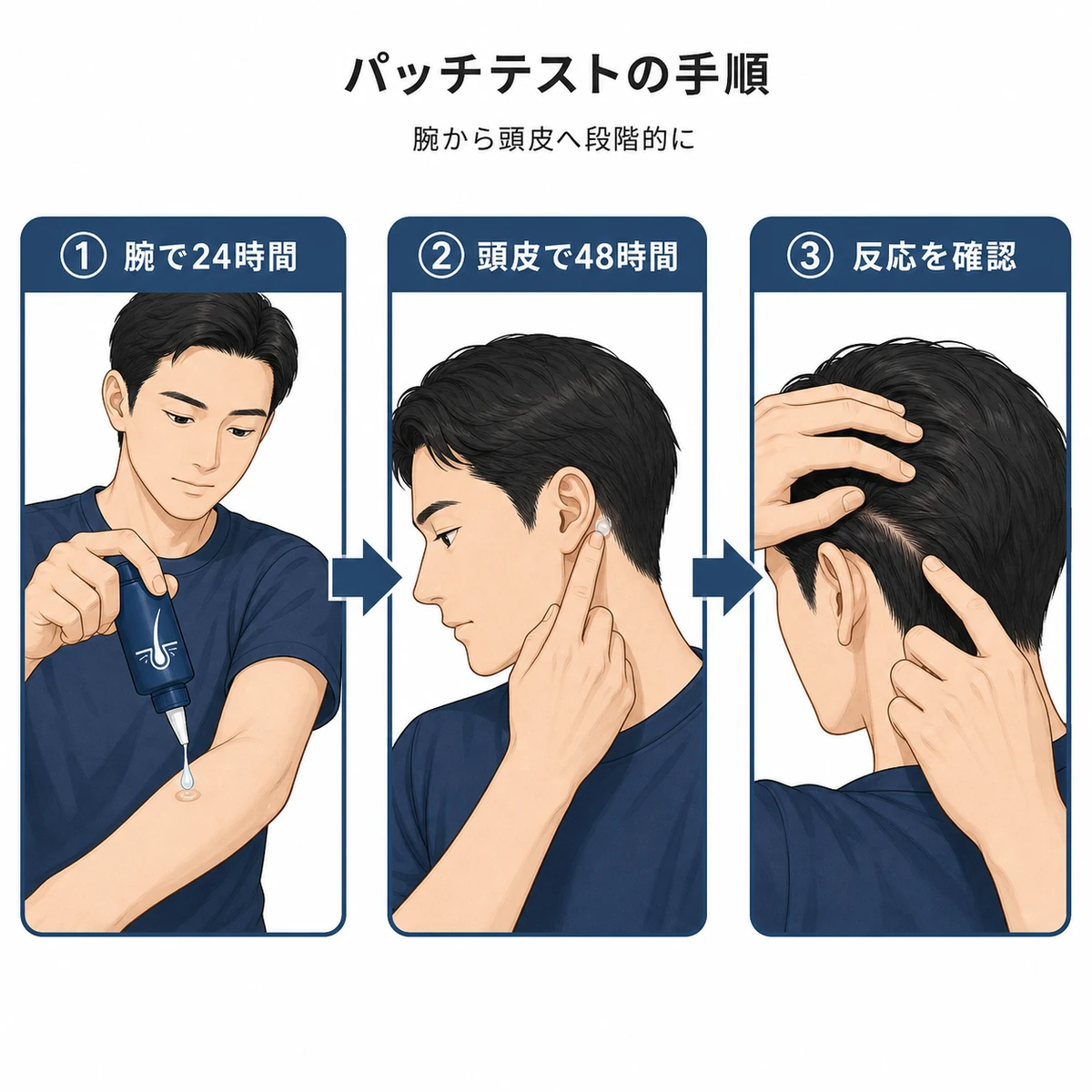腕の内側から頭皮へ段階的に進めるパッチテストの手順を表した医療イラスト