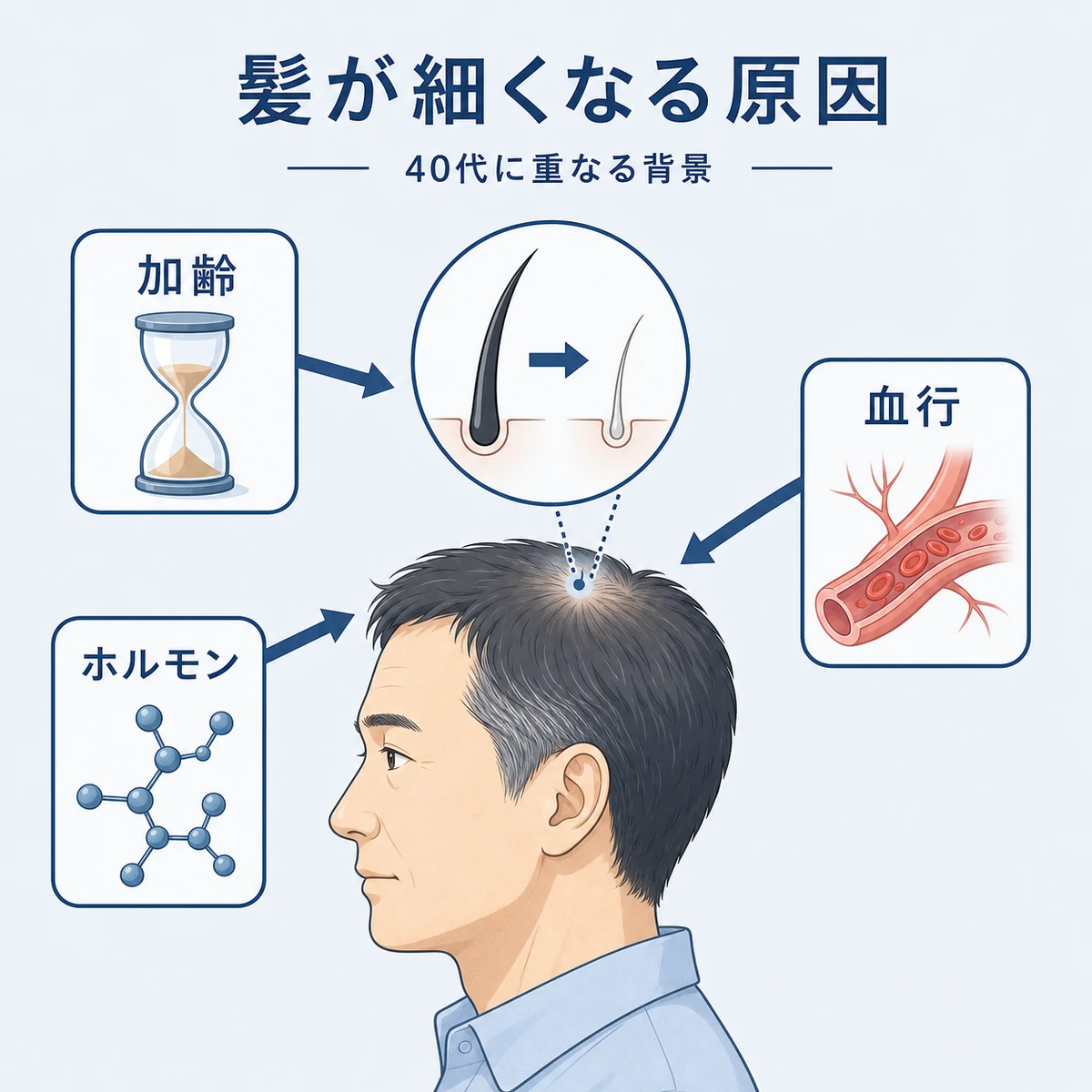 加齢とホルモンと血行不良が重なり40代男性の髪が細くなる背景を表した医療イラスト