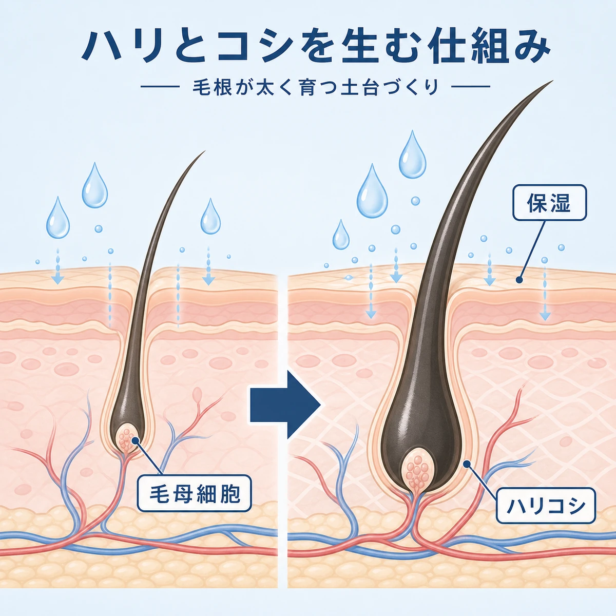 育毛剤の浸透で細い毛が太くハリのある毛へ育つ頭皮断面の変化を示した医療イラスト