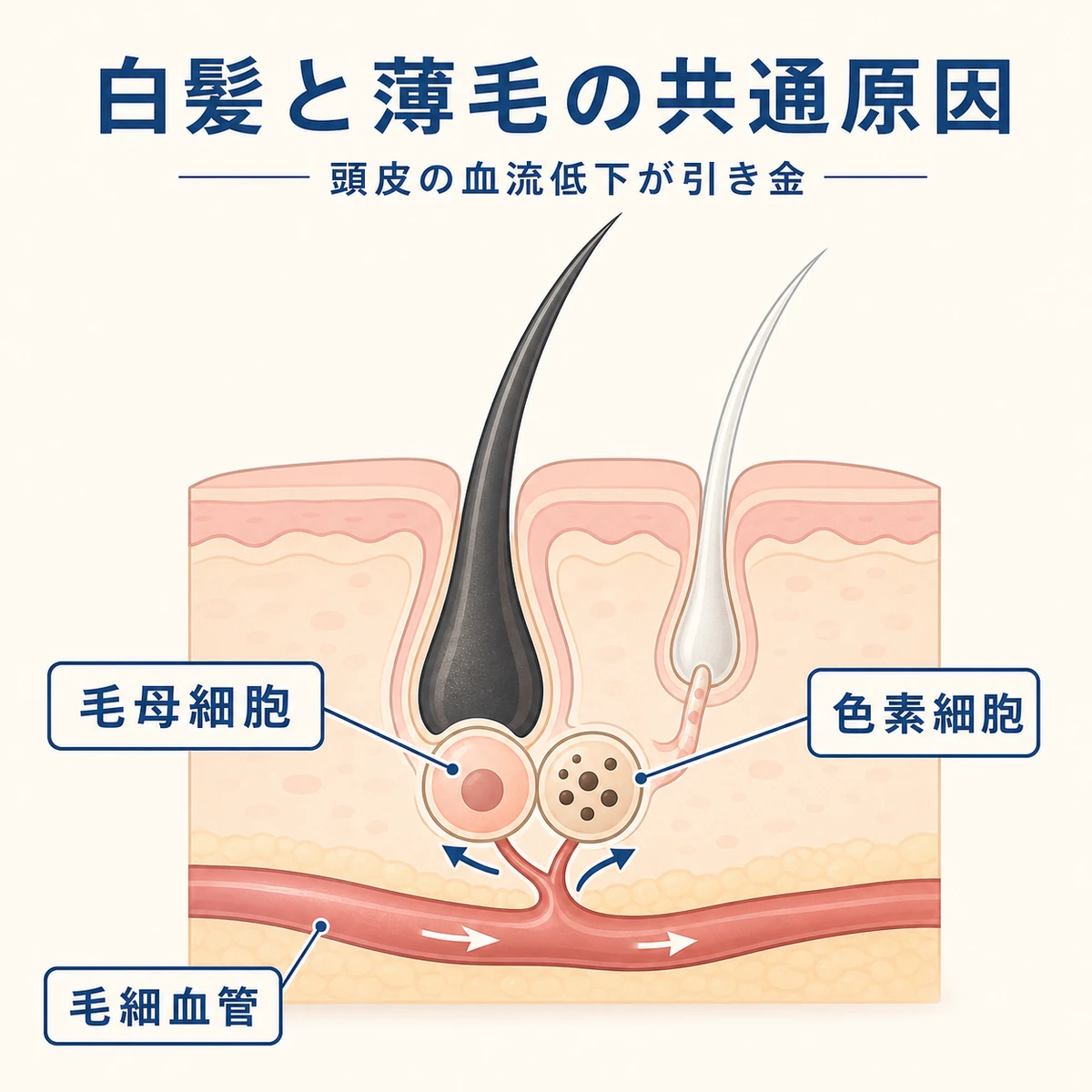 白髪と薄毛に共通する頭皮環境の変化を表した医療イラスト
