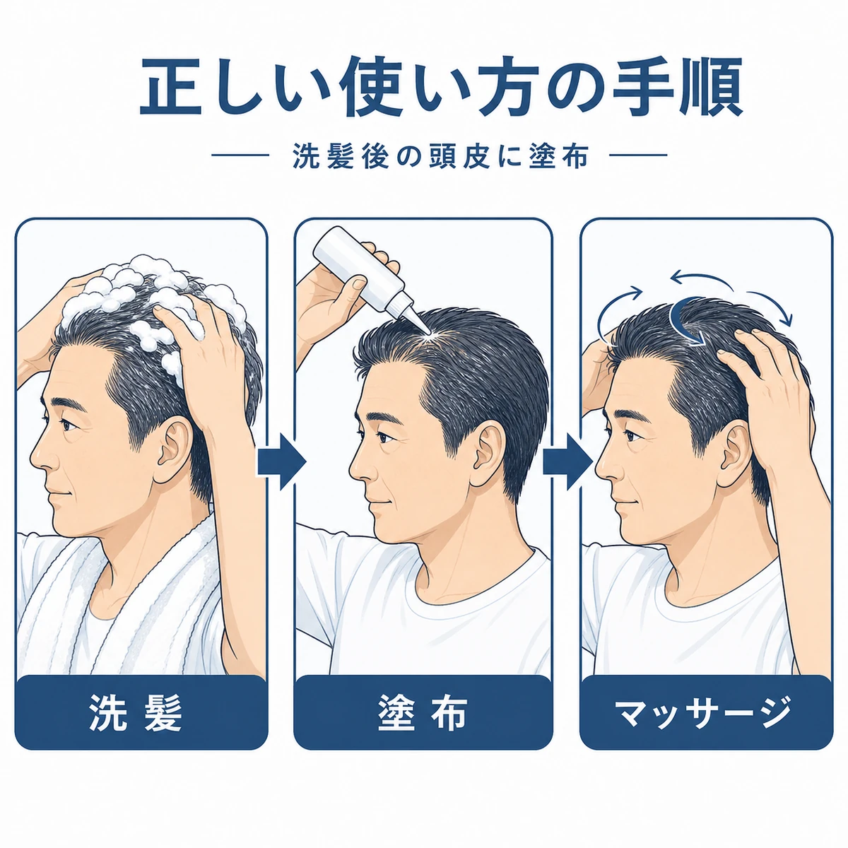 育毛剤を効果的に使う手順を段階的に示した医療イラスト