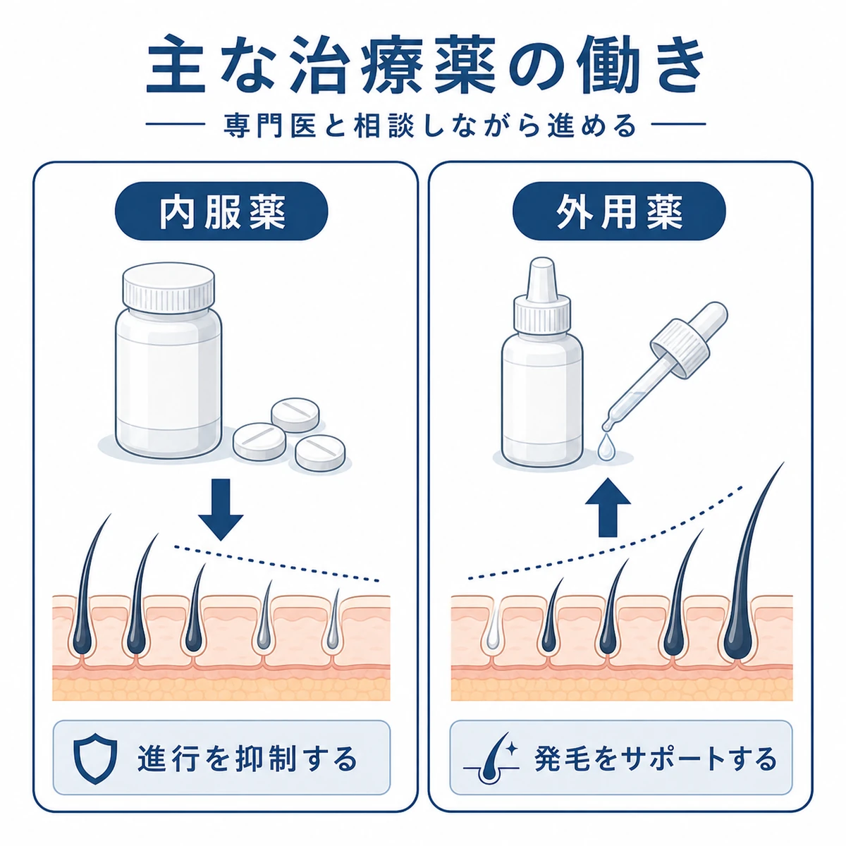 AGA治療で使う内服薬と外用薬の働きの違いを対比した医療イラスト
