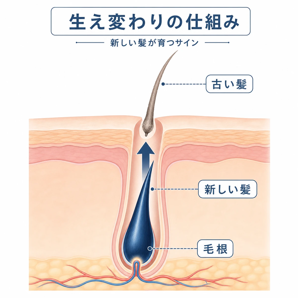 古い髪が抜けて新しい髪が下から生えてくる初期脱毛の仕組みを表した頭皮断面の医療イラスト