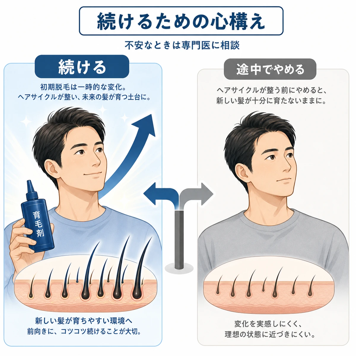 継続すると新しい髪が育つ前向きな未来を選ぶ男性を左右対比で表した医療イラスト