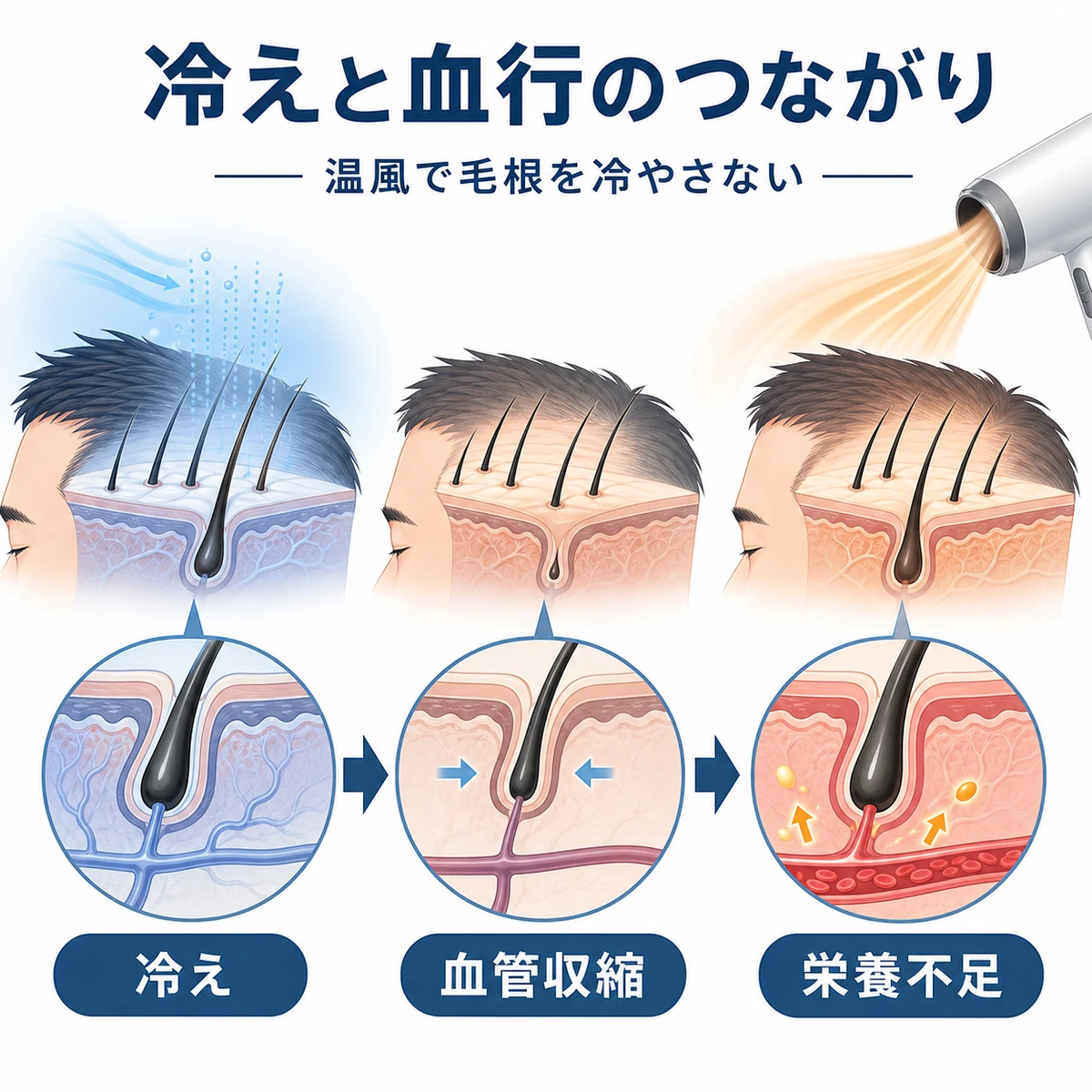 自然乾燥による頭皮の冷えと血行不良のつながりを断面で表した医療系イラスト