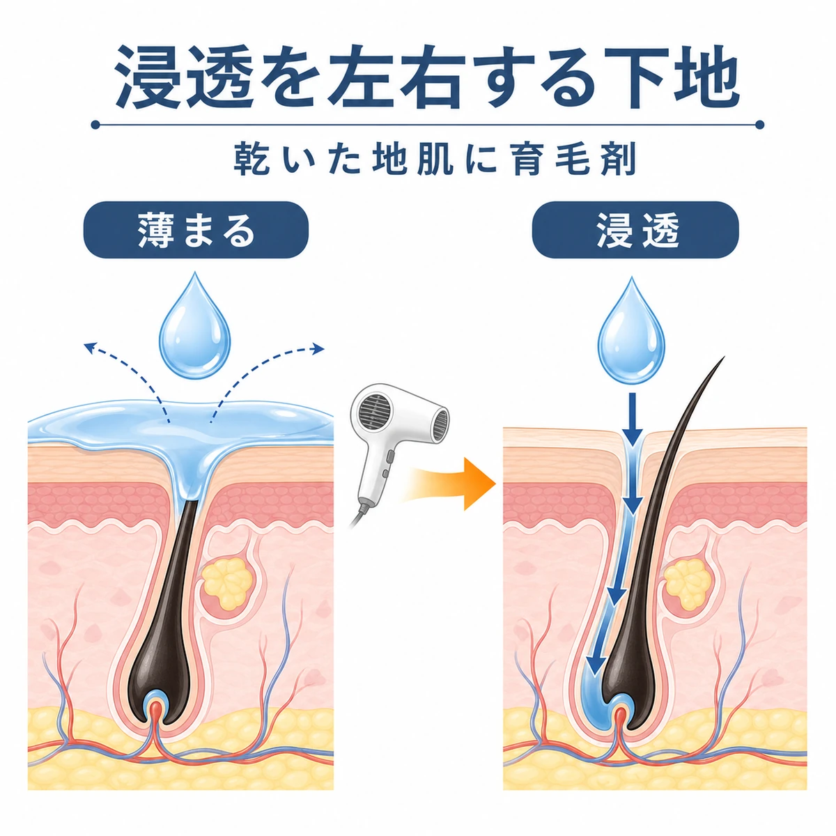 濡れた地肌と乾いた地肌での育毛剤の浸透の違いを毛穴の断面で対比したイラスト