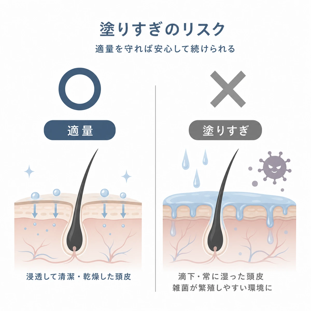 育毛剤の適量と塗りすぎによる地肌への影響を左右で比べたリスク対策を表した医療イラスト