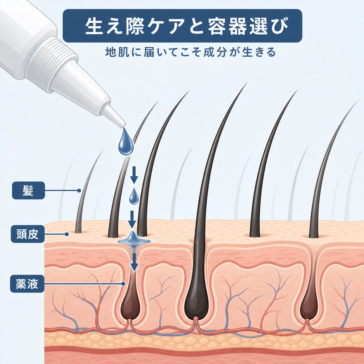 生え際の断面図で薬液が髪の隙間を通り地肌まで届く様子を表した医療イラスト
