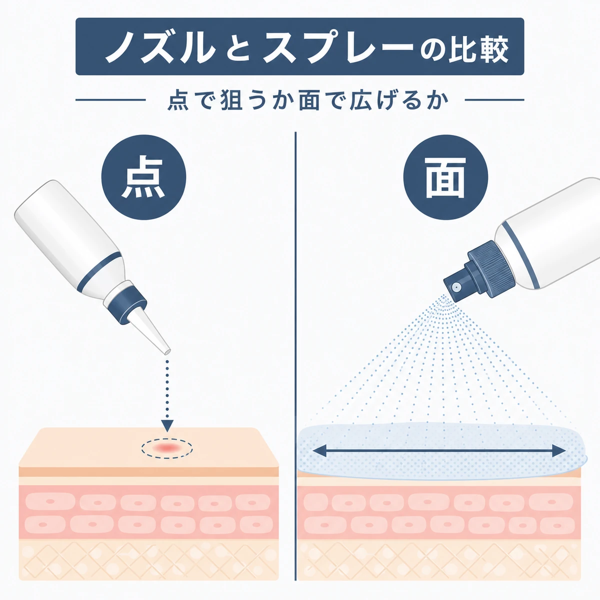 ノズル式とスプレー式の塗布範囲の違いを左右で対比した医療イラスト