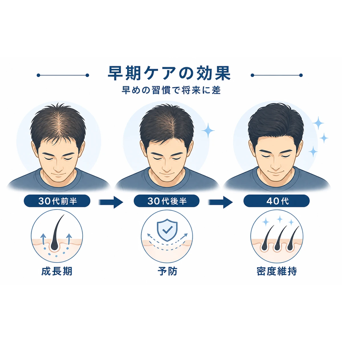 30代男性が早期に育毛ケアを始めることで将来の頭髪密度に差が生まれる流れを時系列で表した医療イラスト