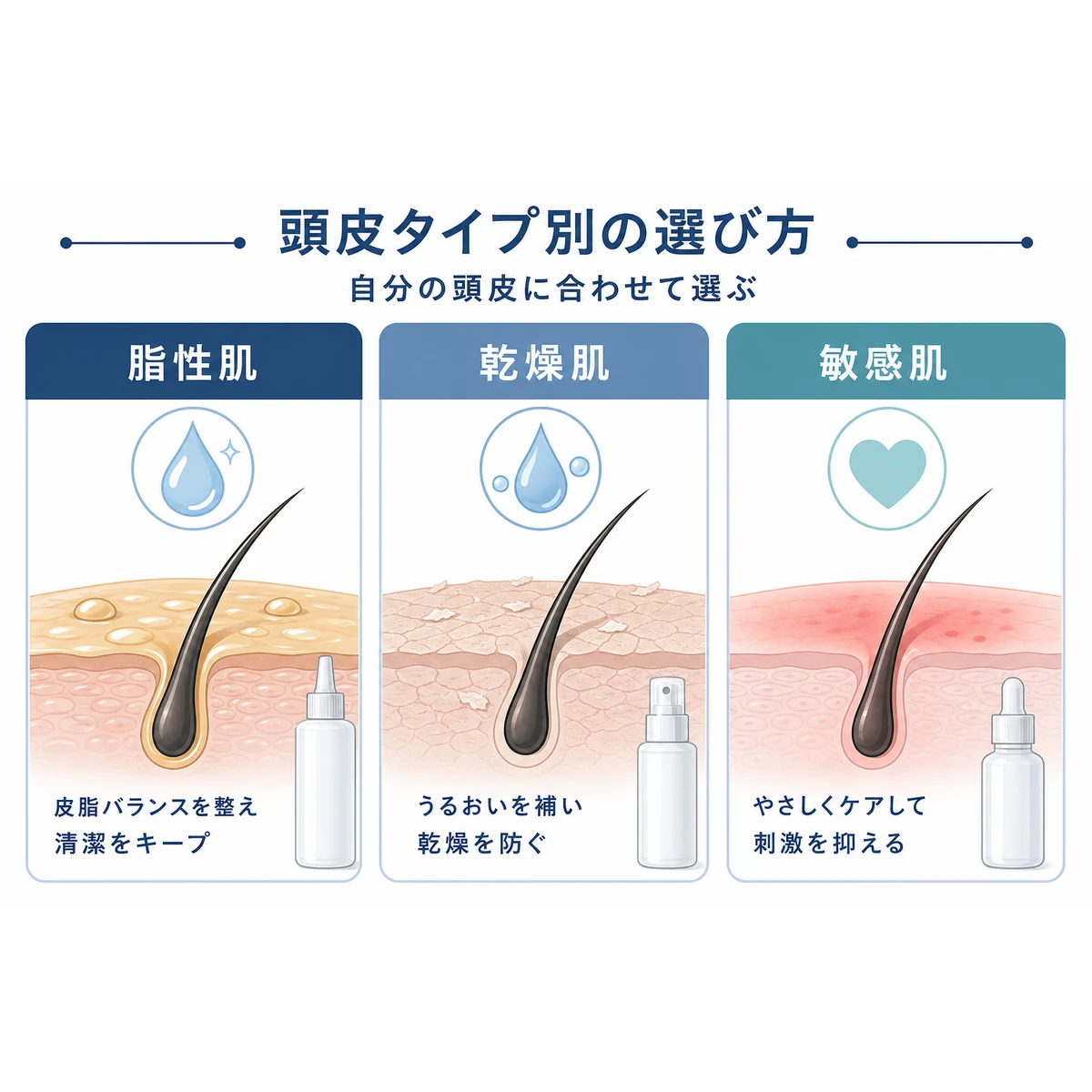 脂性肌・乾燥肌・敏感肌という頭皮タイプ別に育毛剤を選ぶポイントを並べて比較した医療イラスト