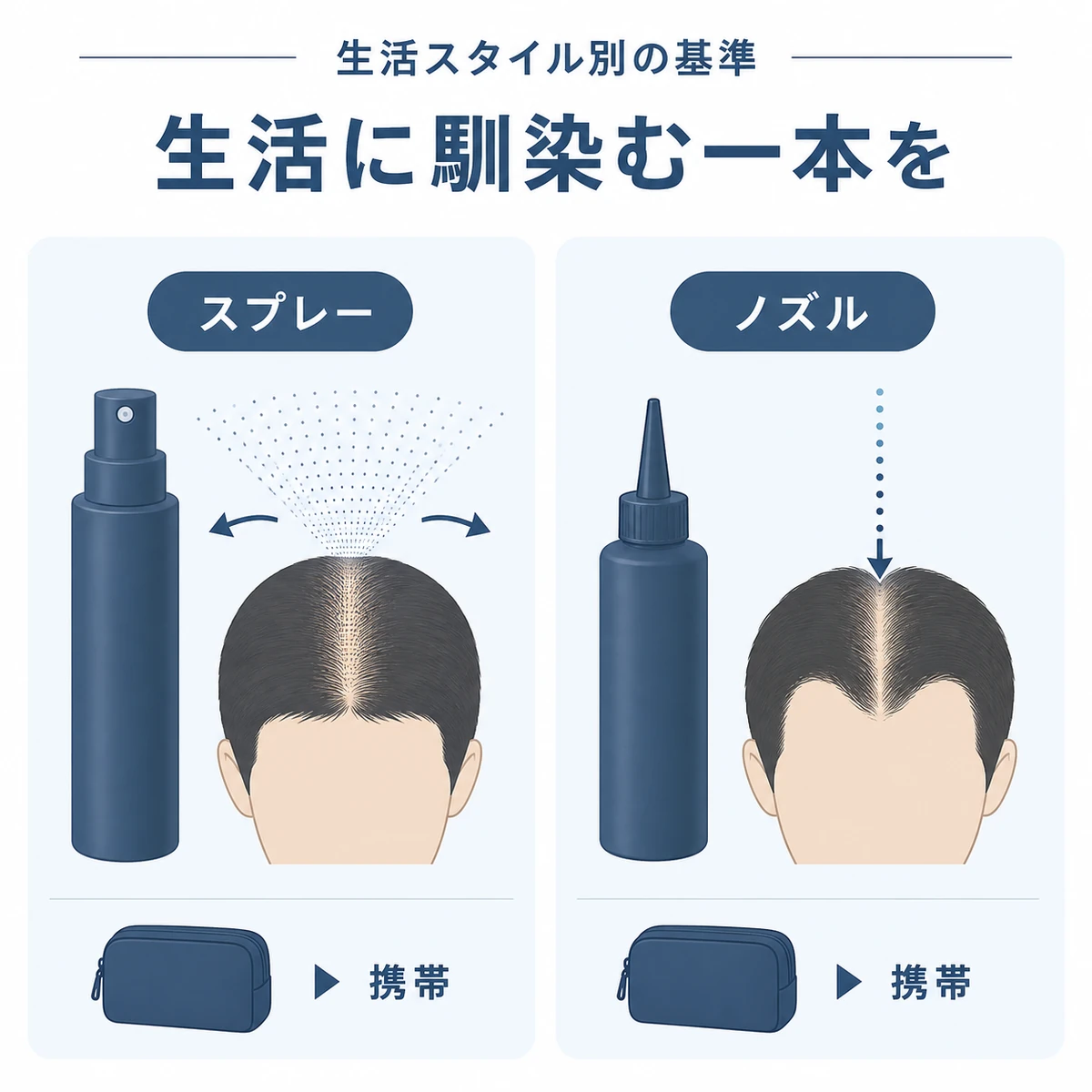 スプレー式とノズル式の使い分けや携帯性など生活に合う育毛剤選びの基準を対比した医療イラスト