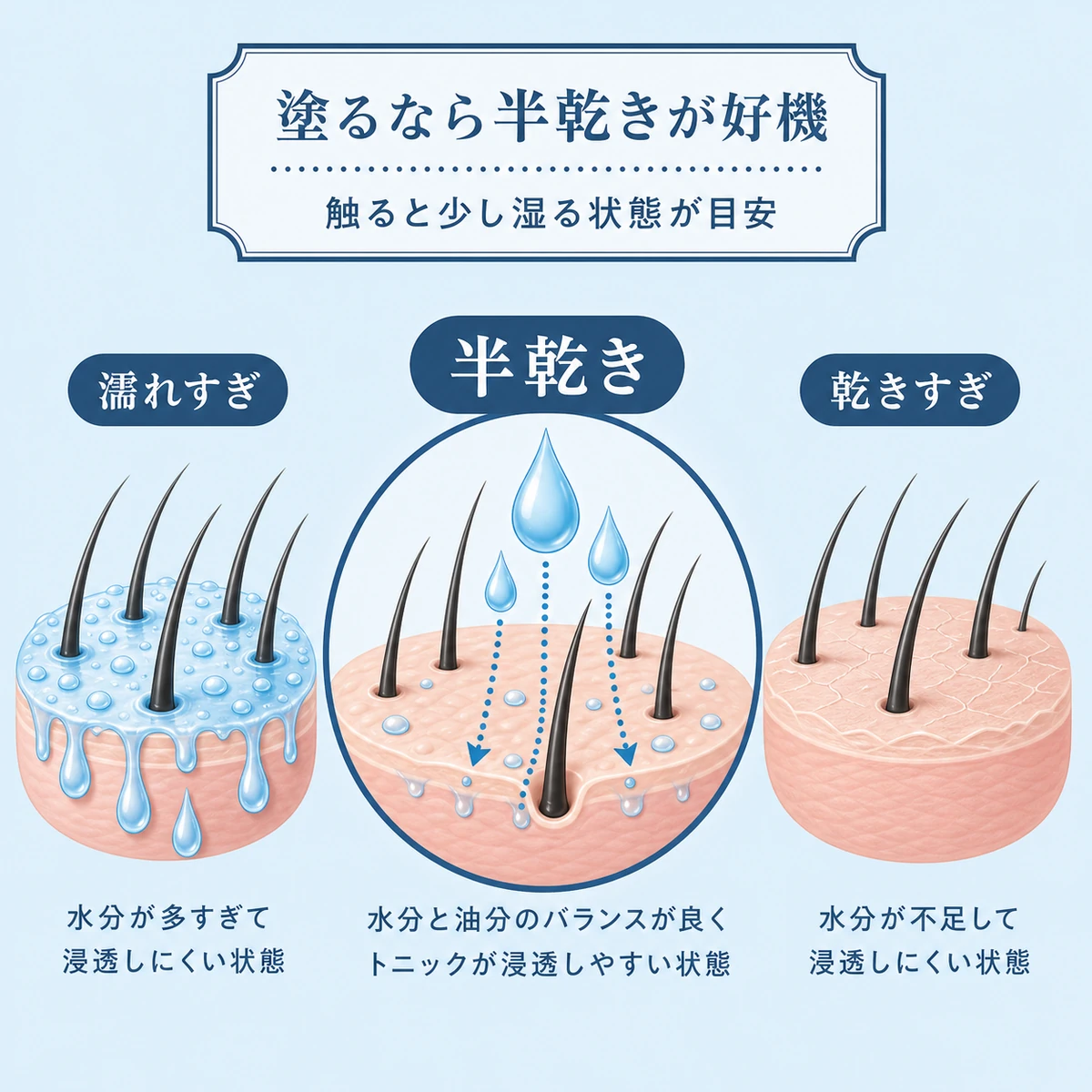 びしょ濡れ・半乾き・完全乾燥で育毛剤の吸収しやすさを比べた頭皮状態の医療イラスト