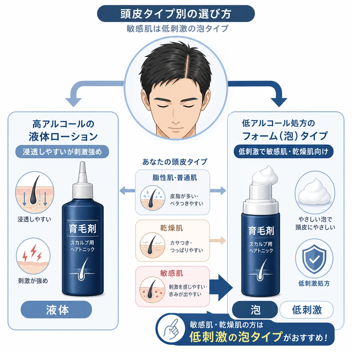 頭皮タイプに合わせて液体タイプと泡タイプの育毛剤を選び分ける流れを表した医療イラスト