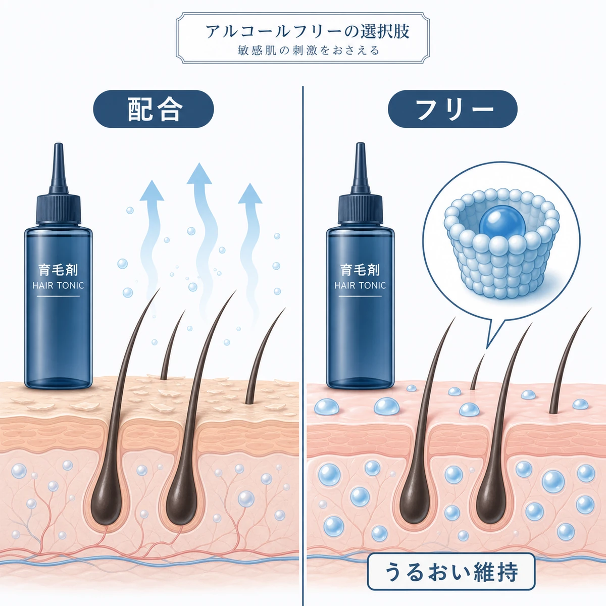 アルコール配合とアルコールフリーの育毛剤を左右で比べ敏感肌への刺激の違いを表した医療イラスト