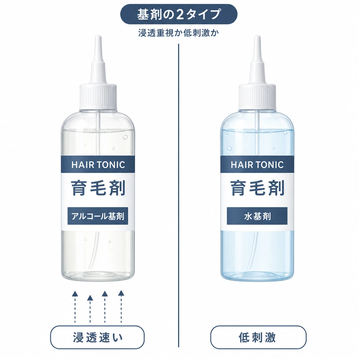 アルコール基剤と水基剤の2本の育毛剤ボトルを左右で対比した医療イラスト