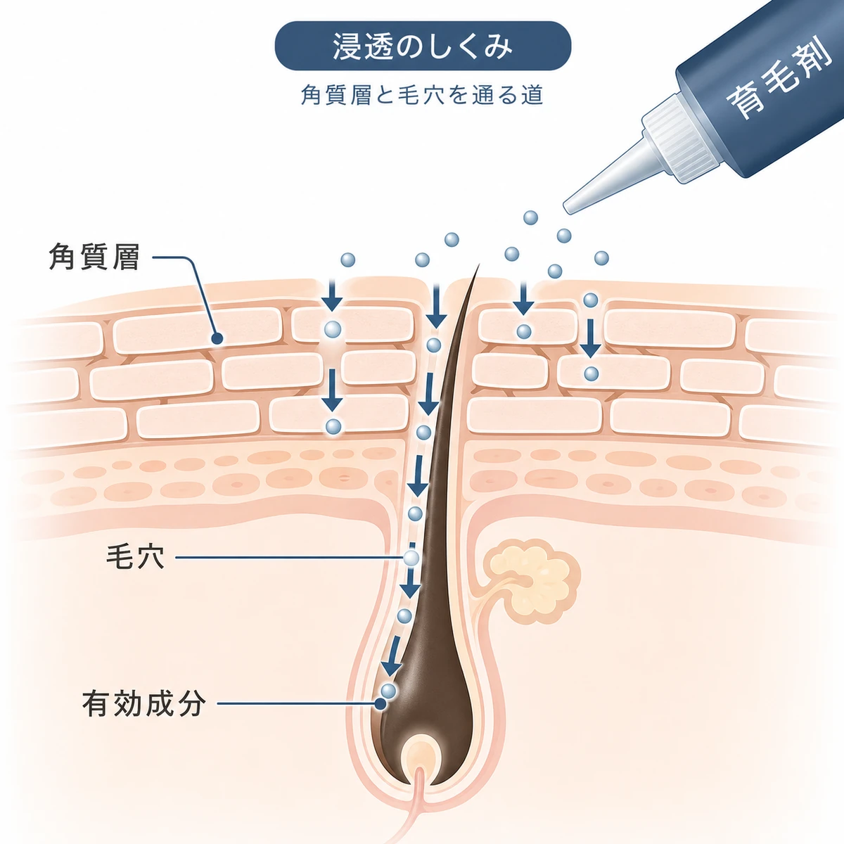 頭皮の角質層と毛穴を通って有効成分が下向きに浸透するしくみを表した医療イラスト