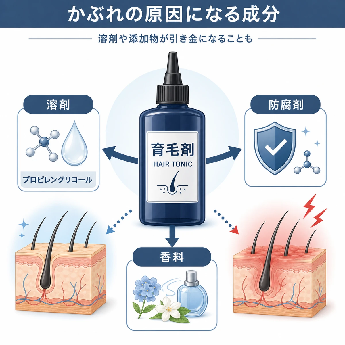 育毛剤ボトルから溶剤や防腐剤などかぶれの原因成分を結びつけた相関図の医療イラスト