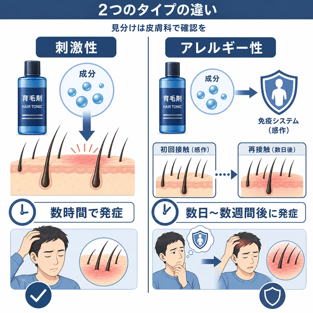 刺激性とアレルギー性の接触皮膚炎を左右で比べた対比の医療イラスト