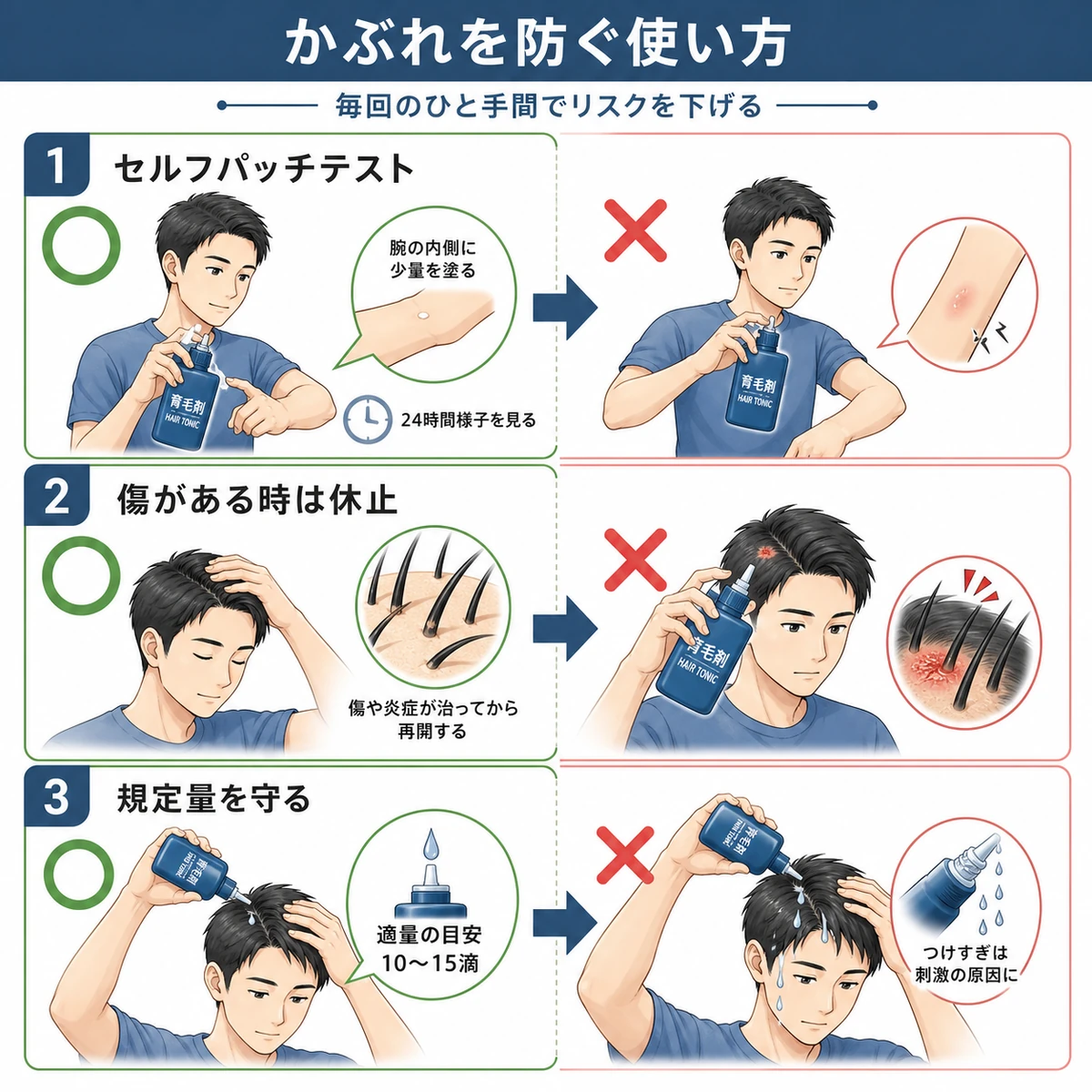 育毛剤の接触皮膚炎を防ぐ正しい使い方を○×で対比したチェックリストの医療イラスト