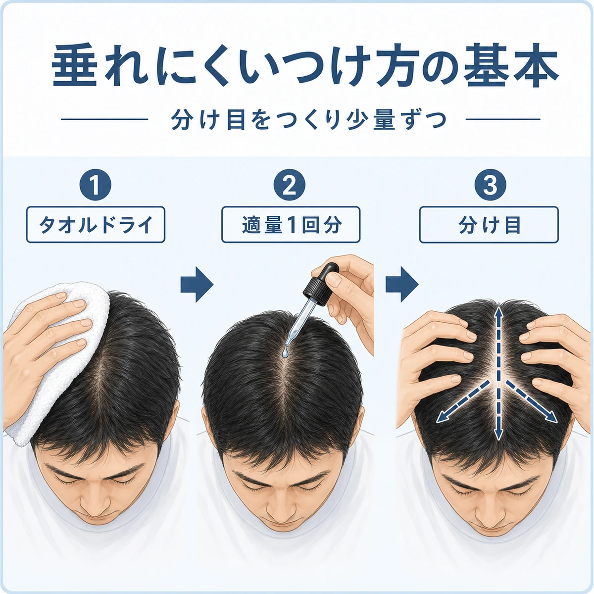 頭皮を整え分け目をつくって少量ずつ塗る正しい育毛剤のつけ方を示した医療イラスト