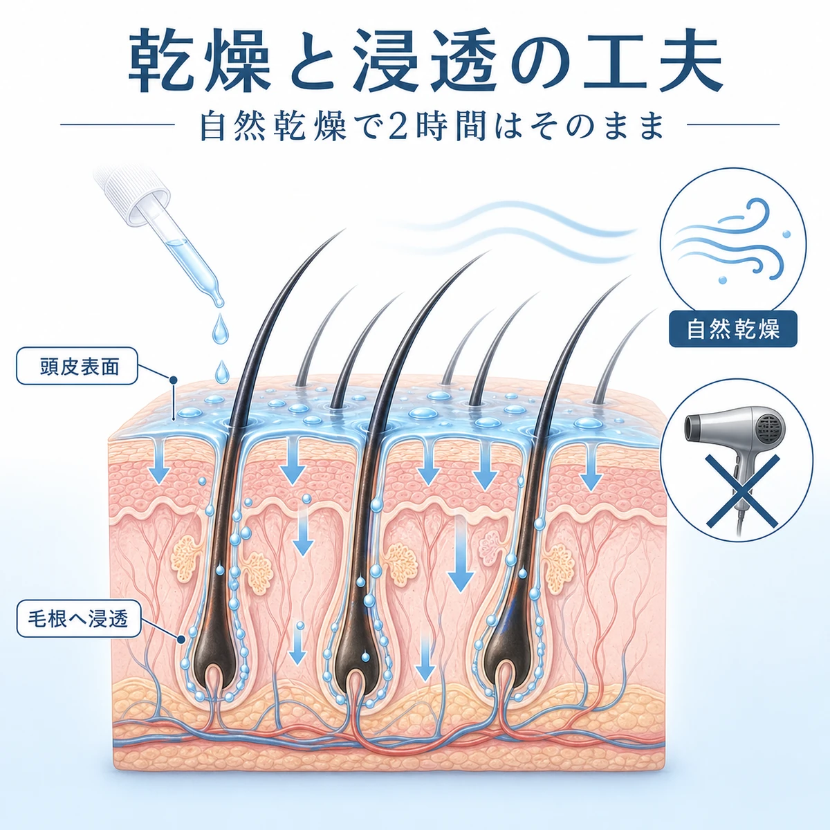 塗布後の育毛剤が頭皮から毛根へゆっくり浸透する様子と自然乾燥の大切さを表した医療イラスト