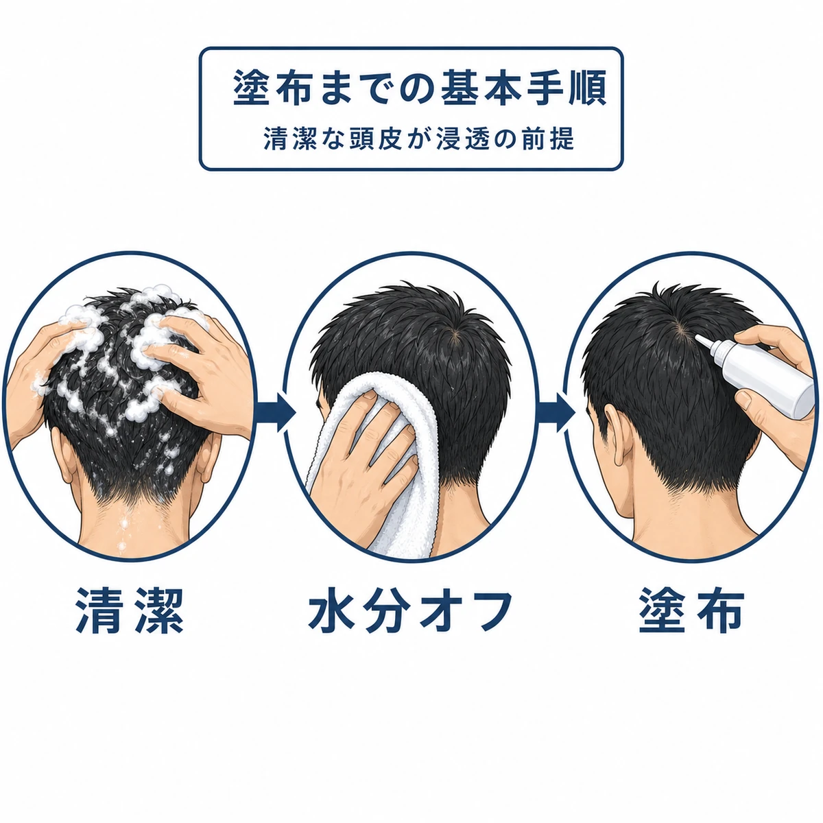 シャンプーからタオルドライを経て育毛剤を塗布するまでの正しい手順を左から右へ示した医療イラスト