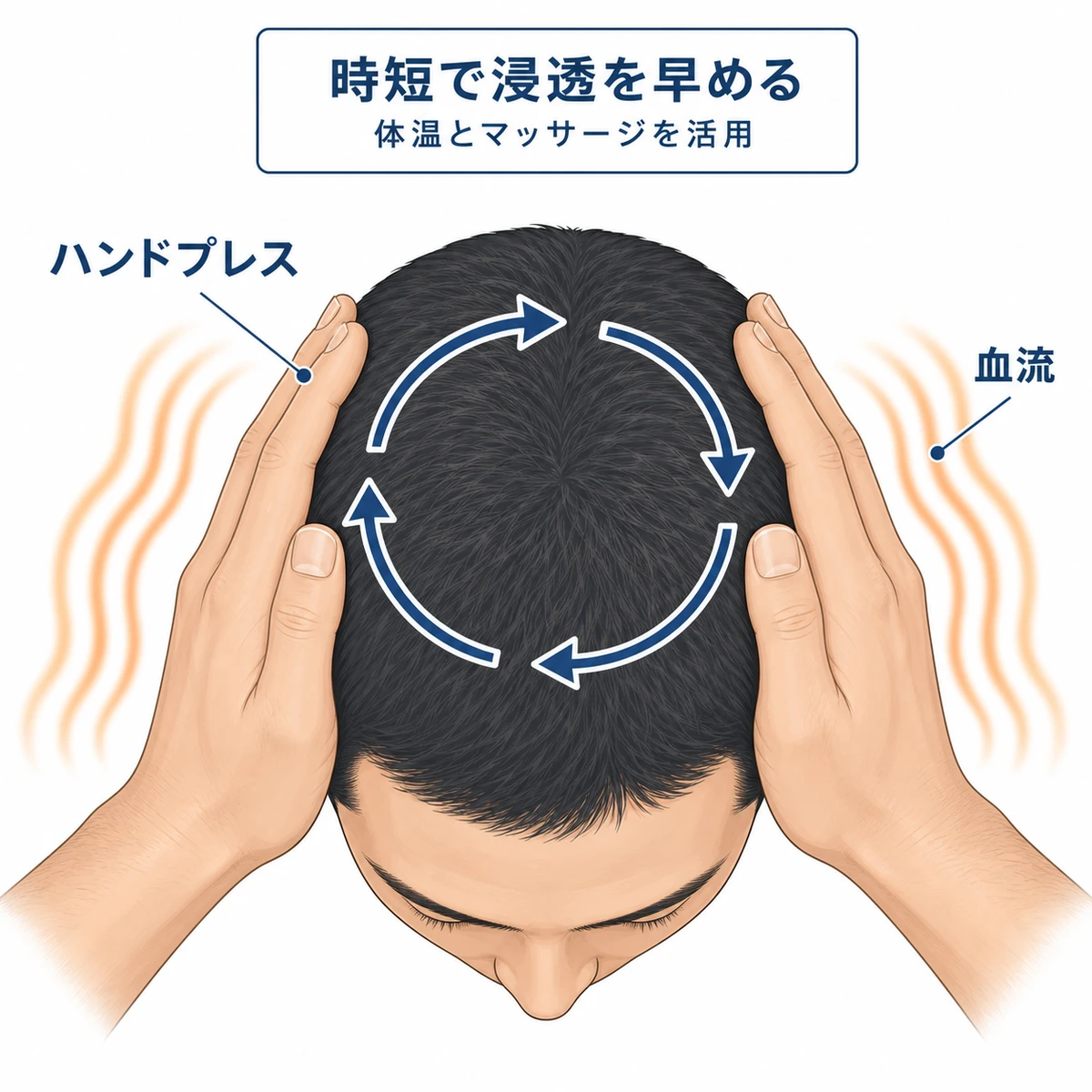手のひらのハンドプレスと頭皮マッサージで育毛剤の浸透を早める方法を頭頂部の俯瞰で表した医療イラスト
