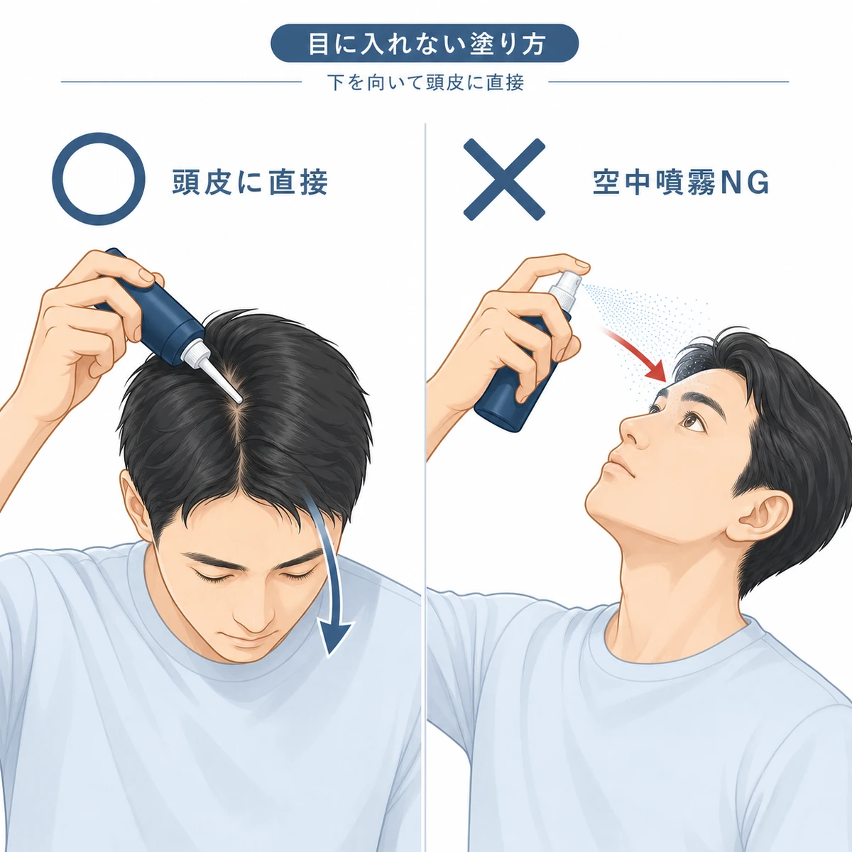 育毛剤を頭皮に直接塗る安全な方法と空中噴霧を避けるべき例を対比した医療イラスト