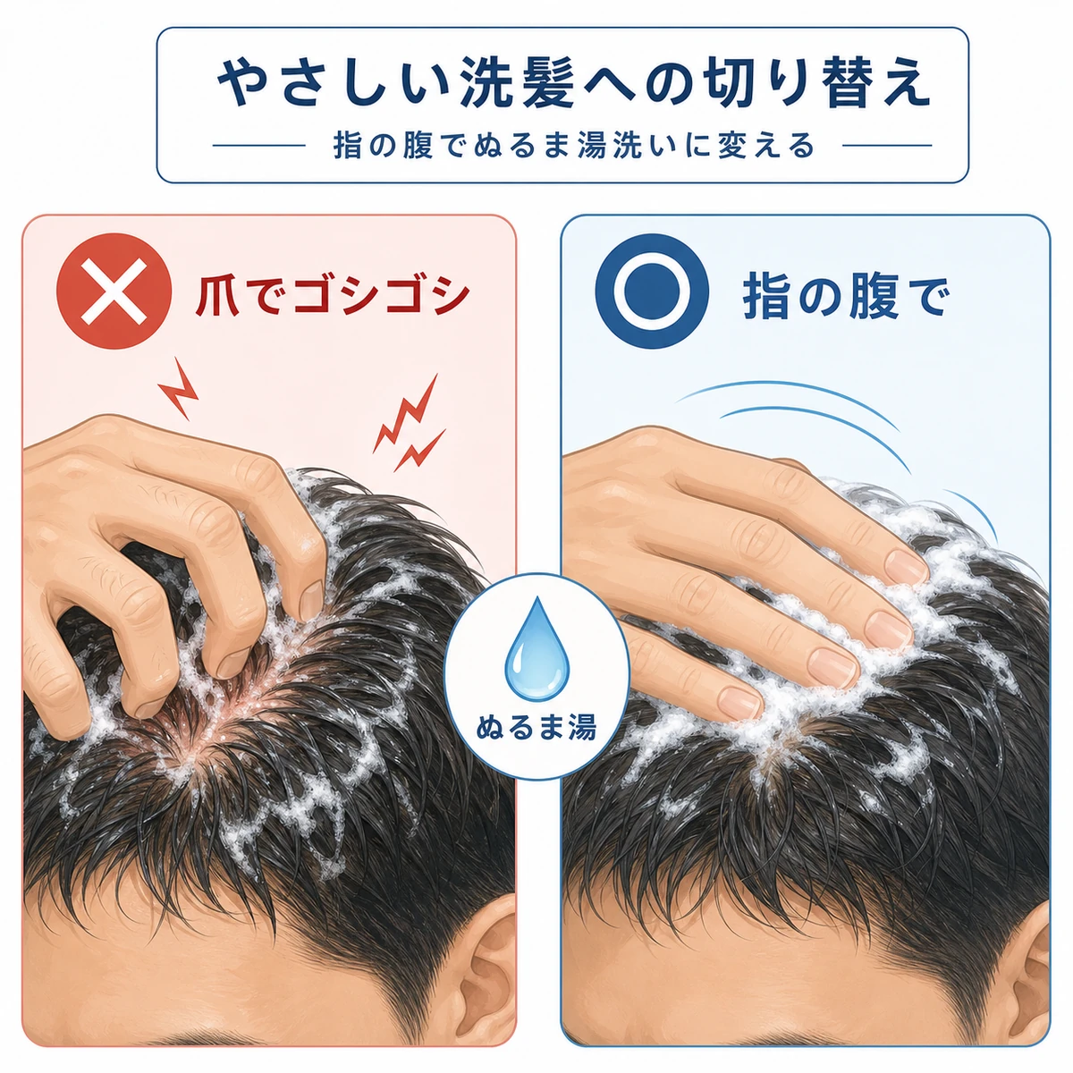 爪でゴシゴシ洗う方法と指の腹で優しく洗う方法を対比したシャンプーの見直しを表した医療イラスト