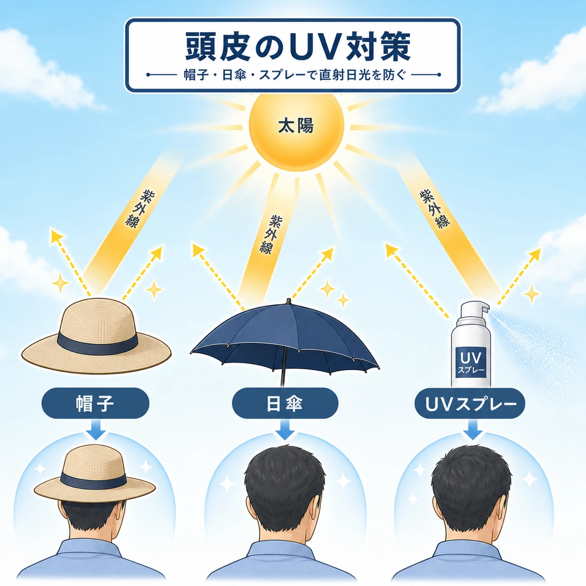 帽子や日傘や頭皮用スプレーで降り注ぐ紫外線から頭皮を守るUV対策を表した医療イラスト