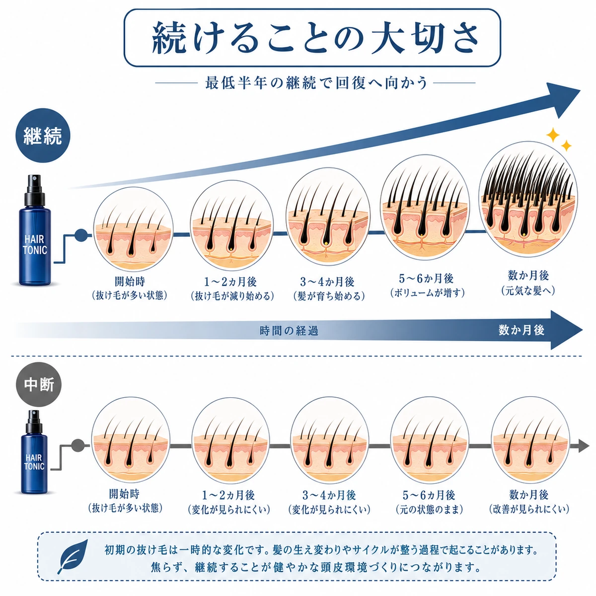 育毛剤を継続した場合と中断した場合の毛量の変化を左から右へ対比したタイムラインの医療イラスト