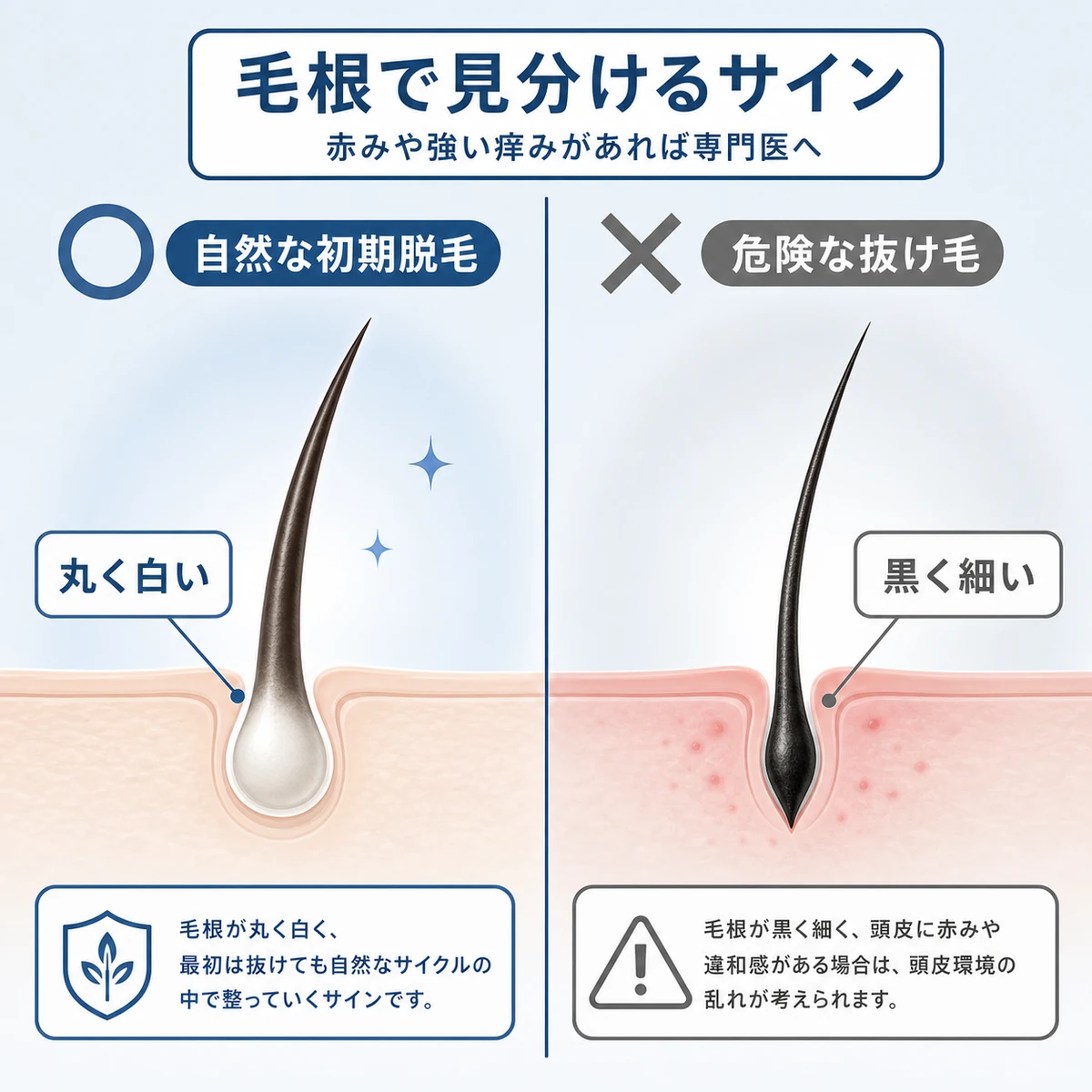 初期脱毛の丸い毛根と危険な抜け毛の細い毛根を左右で比べた見分け方の医療イラスト