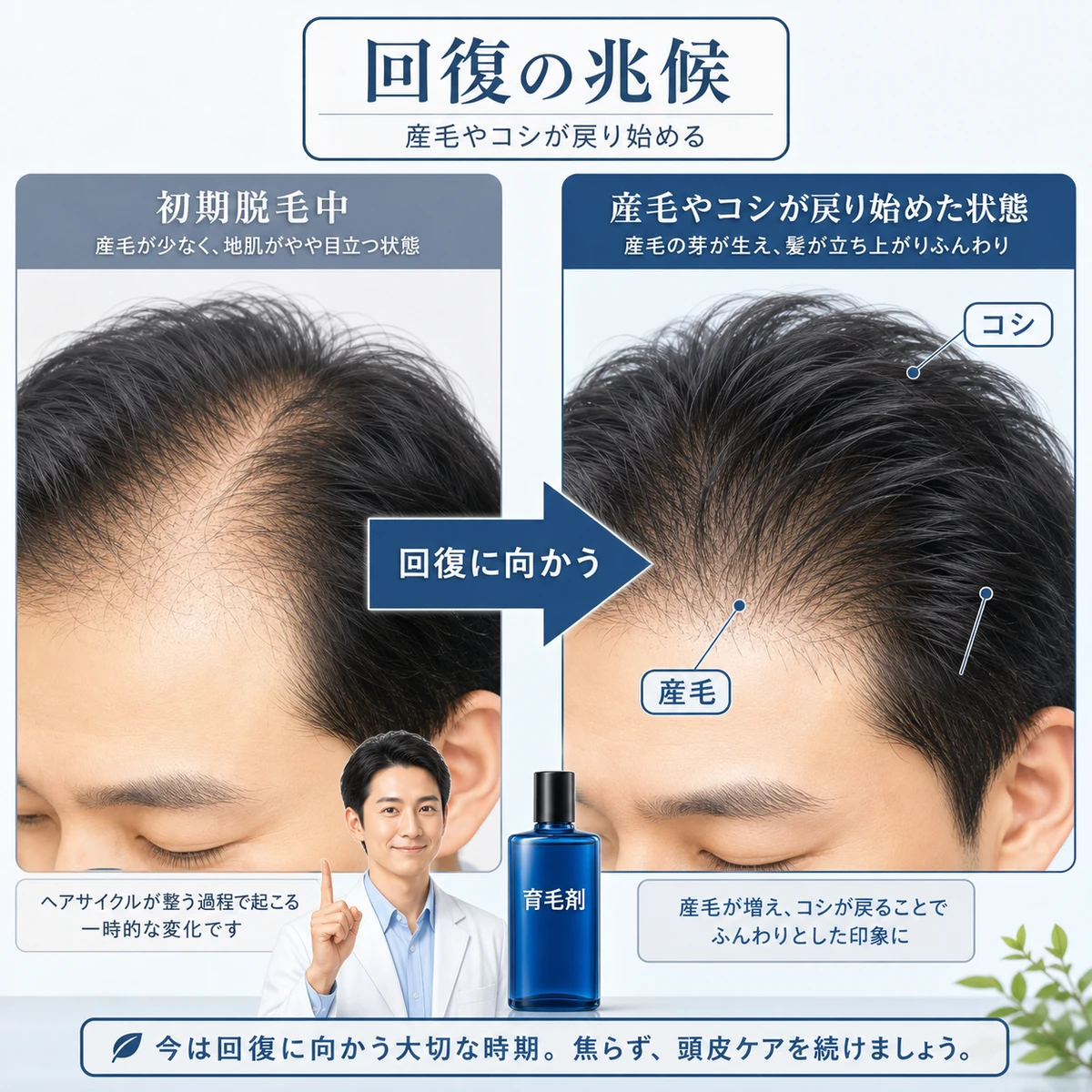 産毛が生えコシが戻り回復へ向かう頭皮の変化を左右で表した医療イラスト