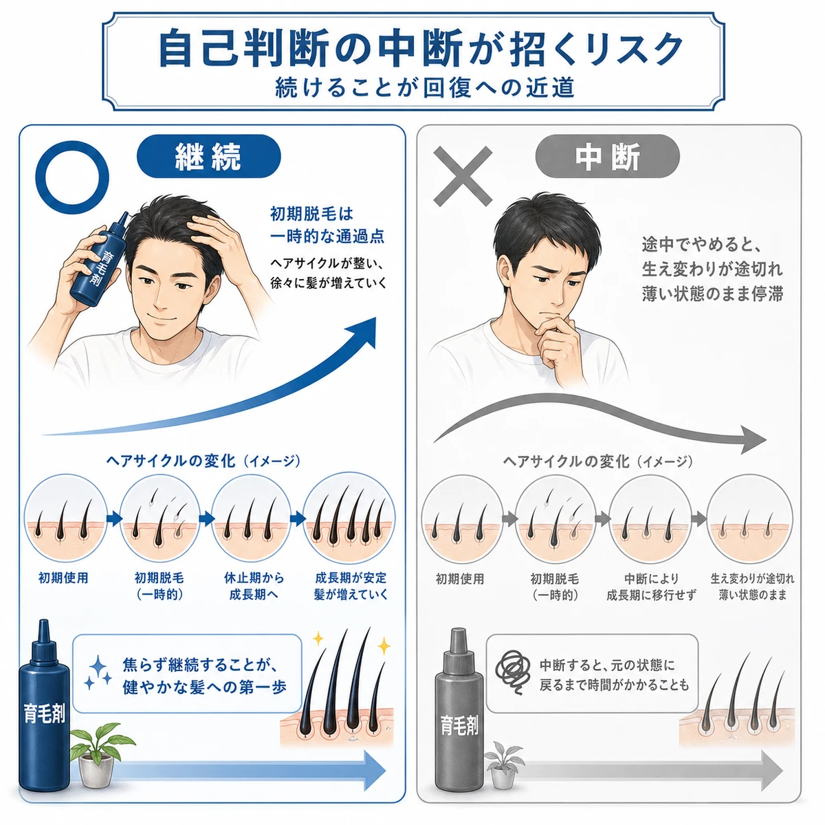 育毛剤を継続する場合と自己判断で中断する場合の違いを対比した医療イラスト