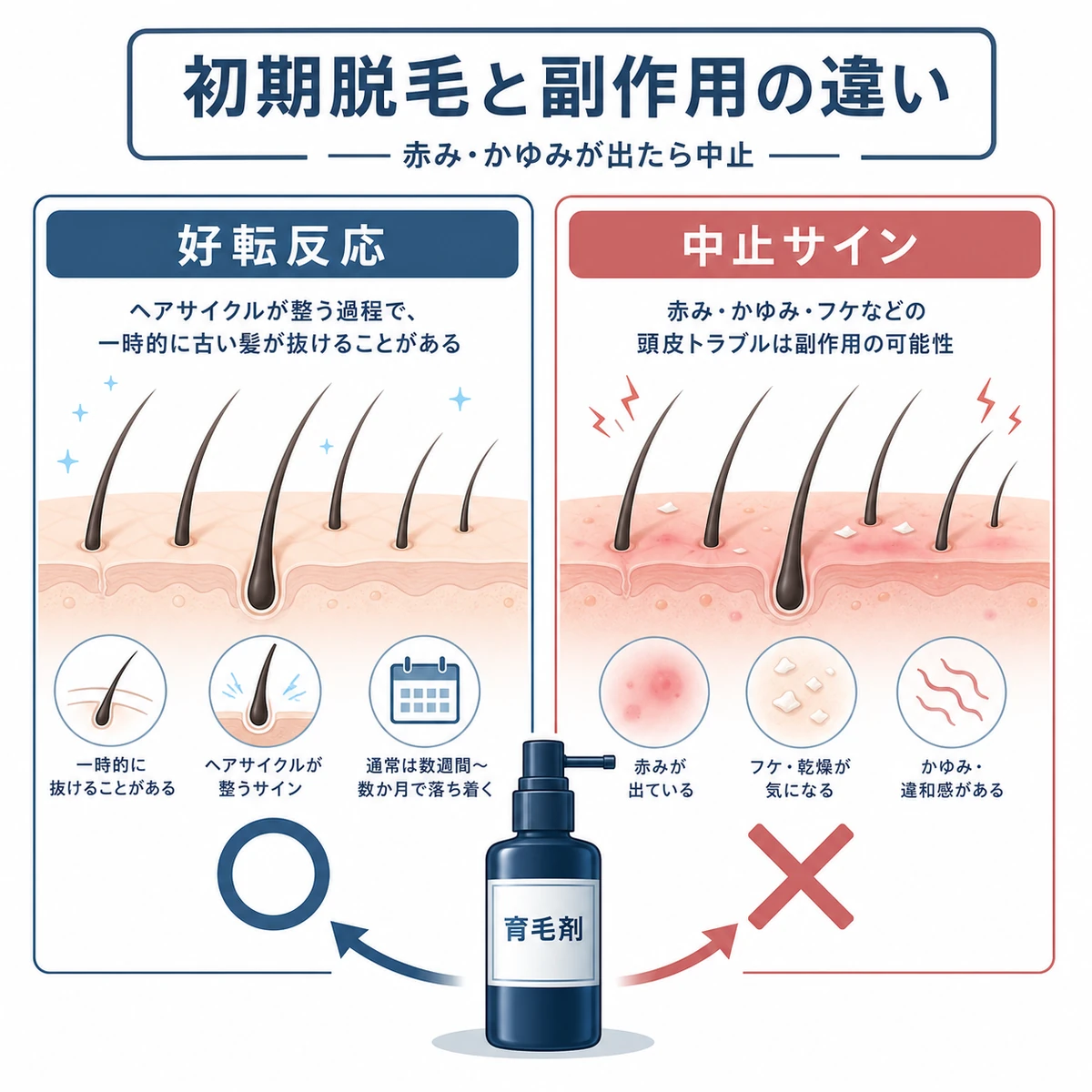 初期脱毛と頭皮トラブルの見分け方を左右で対比した医療イラスト