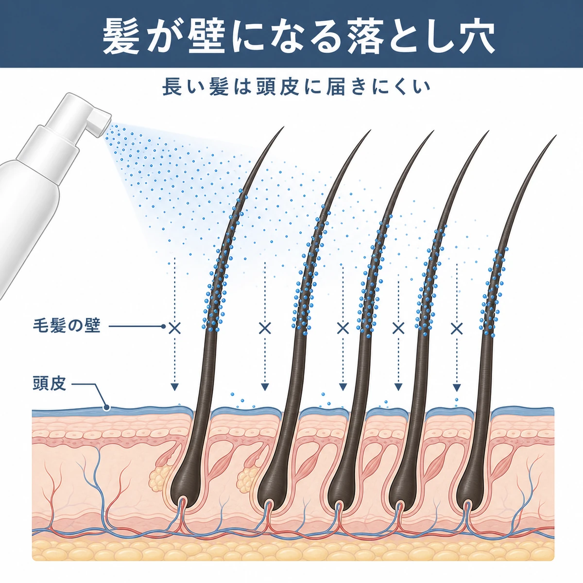 長い髪が壁となりスプレーの霧が頭皮まで届きにくい様子を断面で表した育毛剤の解説イラスト