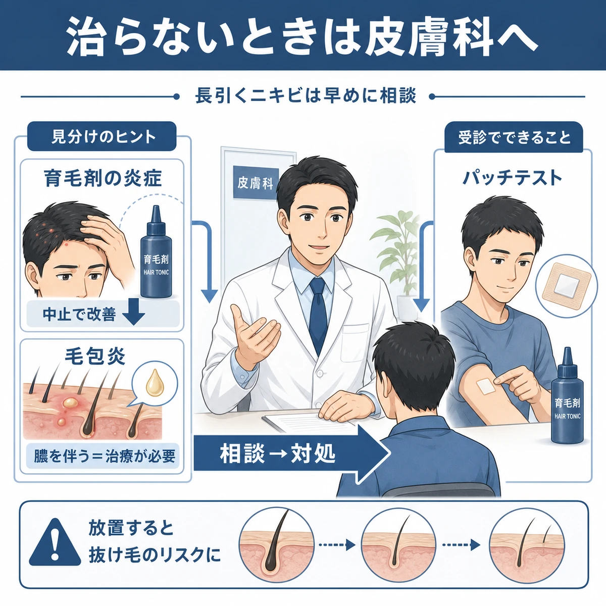 長引く頭皮ニキビを皮膚科の男性医師に相談し、毛包炎の見分けやパッチテストで対処する流れを示した医療イラスト