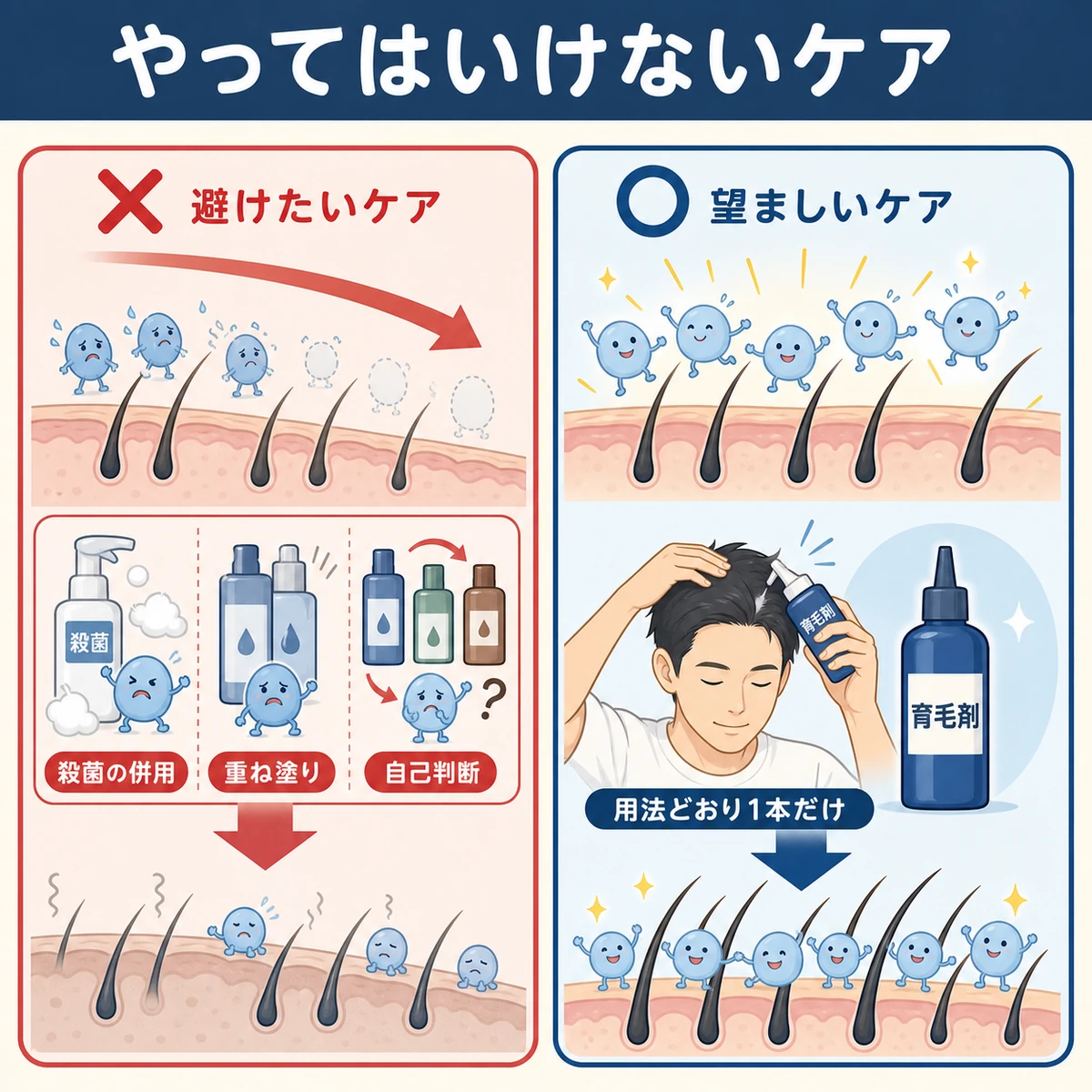 殺菌シャンプー併用や重ね塗りなど菌バランスを崩すNGケアを対比して表した医療イラスト