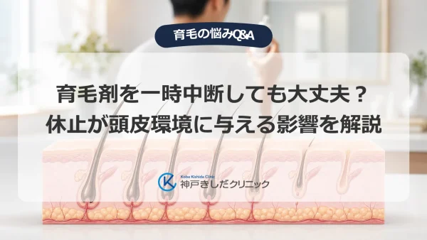 育毛剤を一時中断しても大丈夫？休止が頭皮環境に与える影響を解説
