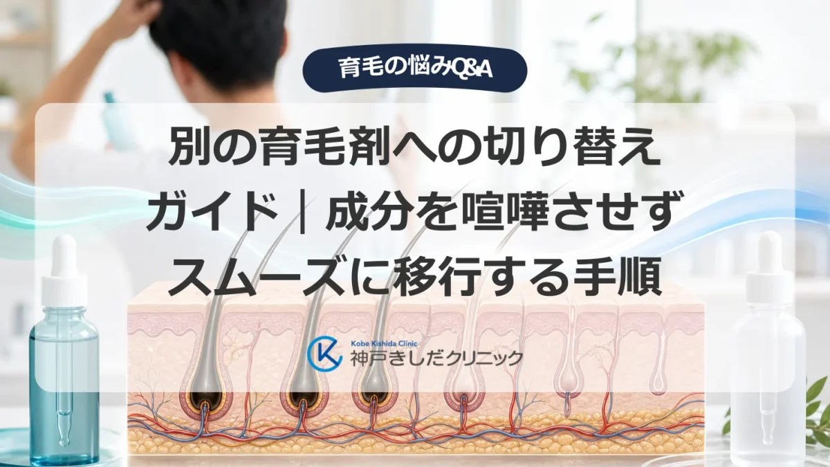 育毛剤の切り替えを検討する男性と、頭皮と毛包の断面を示した医療イラスト