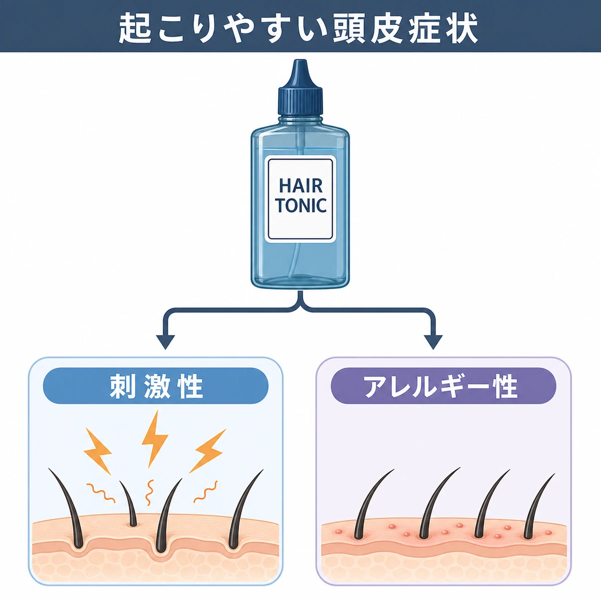 育毛剤の成分による刺激性とアレルギー性の頭皮症状の違いを対比で表した医療イラスト
