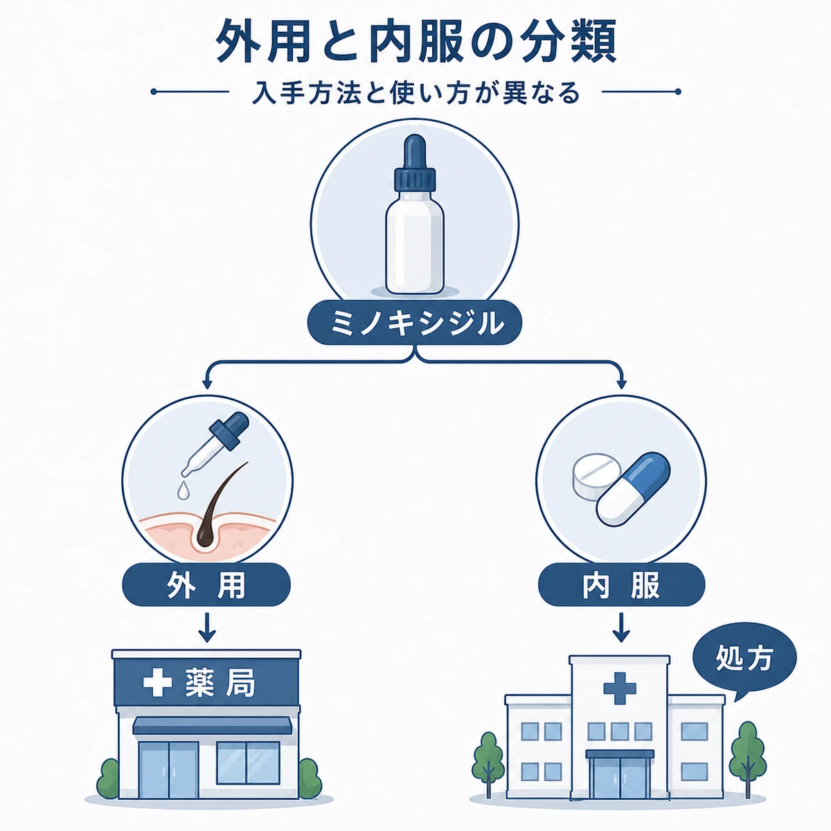 ミノキシジルの外用と内服の位置づけを枝分かれで表した医療イラスト