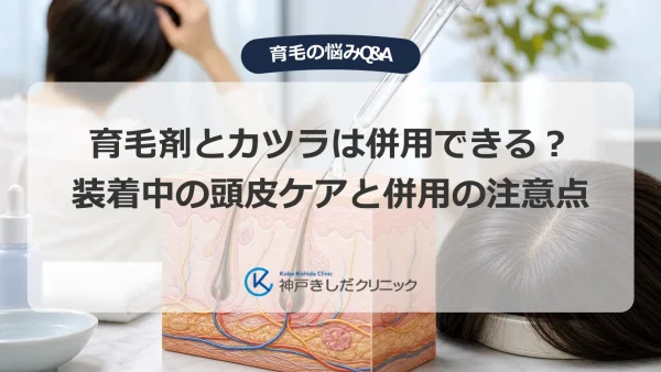 育毛剤とカツラは併用できる？装着中の頭皮ケアと併用の注意点