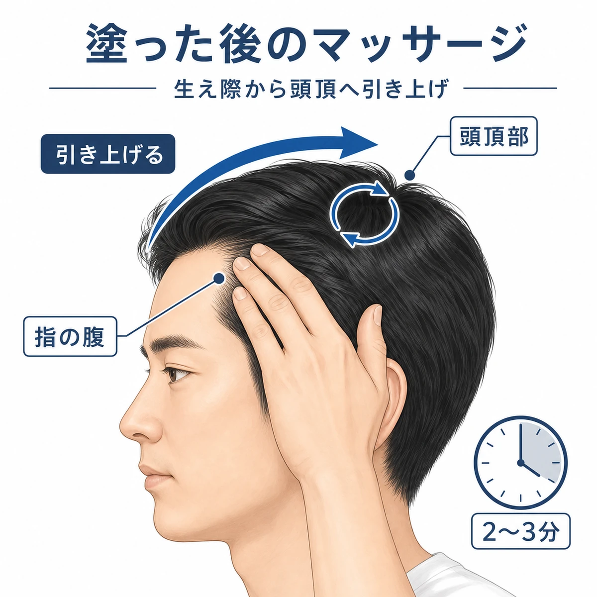 生え際から頭頂部へ引き上げる頭皮マッサージの方向を表した医療イラスト