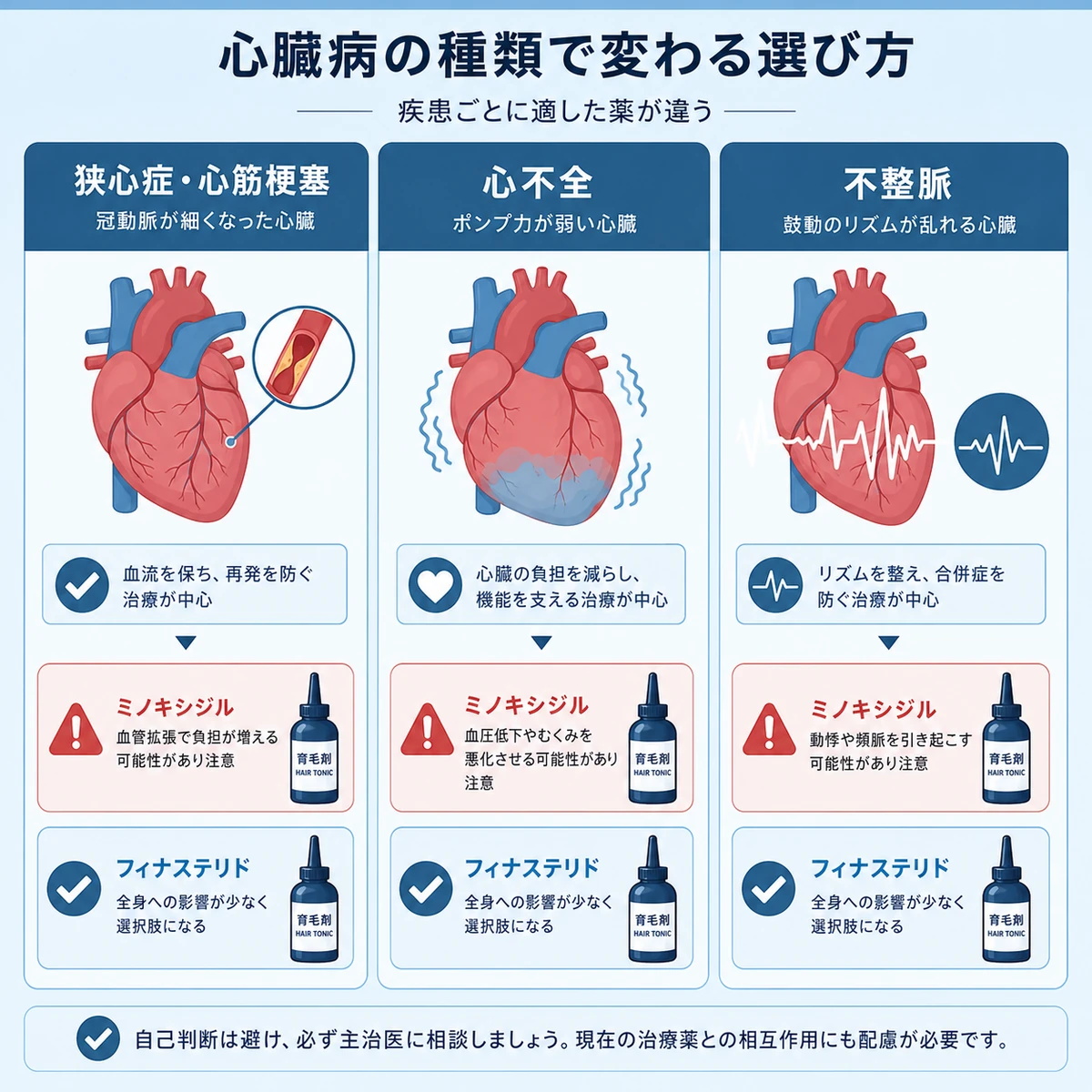 狭心症や心不全や不整脈など心臓病の種類ごとに育毛剤の選び方が変わることを示した医療イラスト