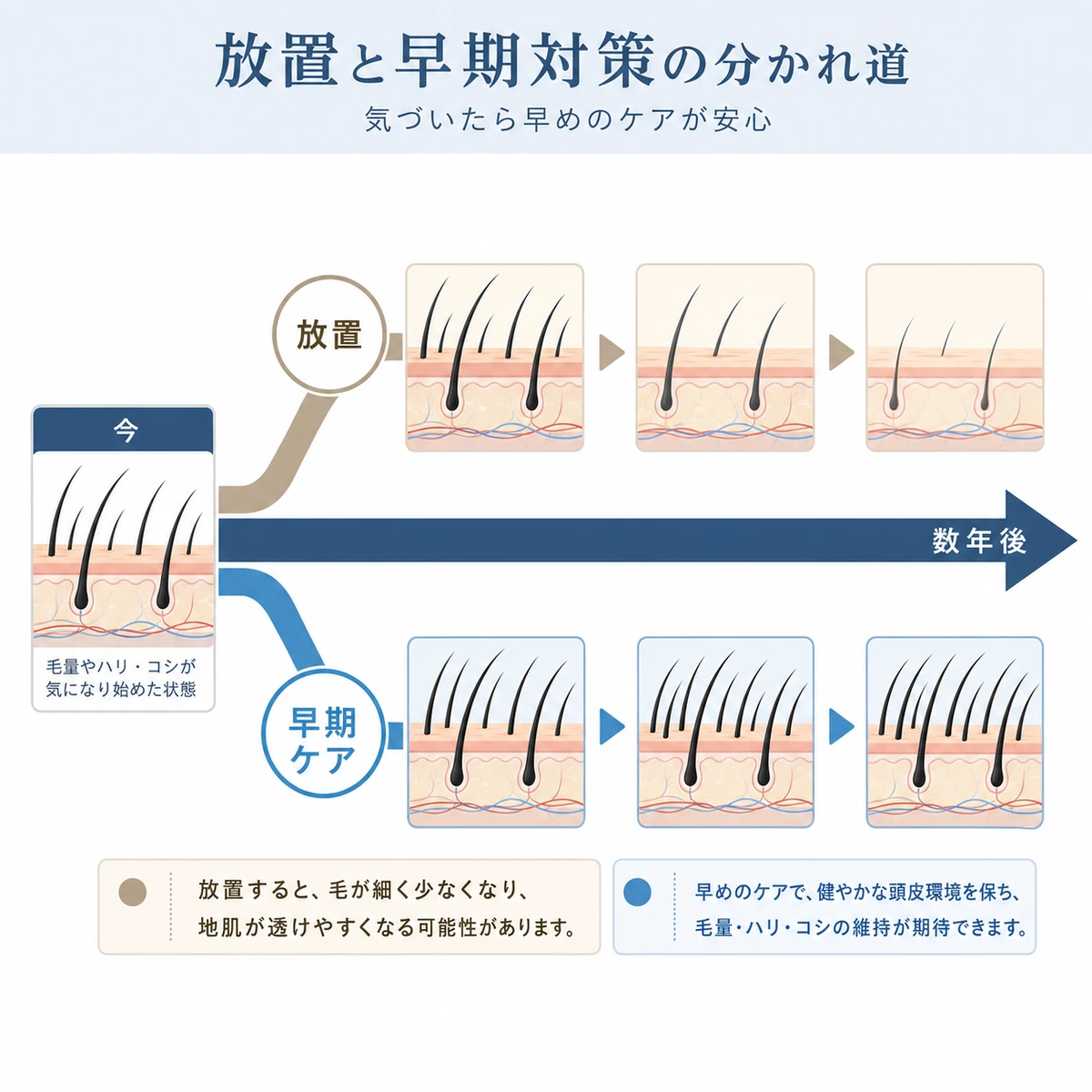薄毛を放置した場合と早期にケアした場合の将来の差を対比した医療イラスト